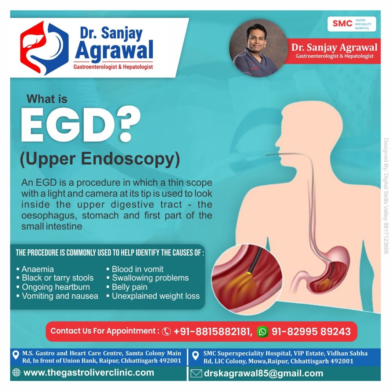 Understanding EGD: Diagnosis and Treatment of GI Conditions