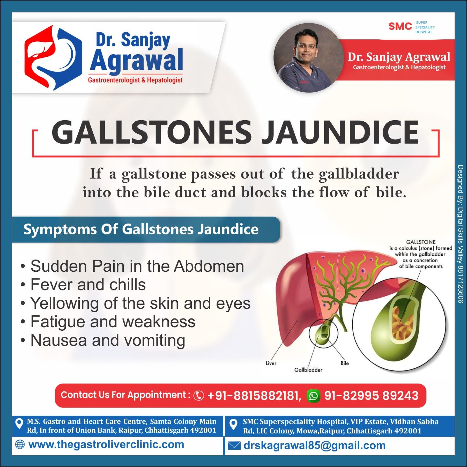 Gallstones Jaundice