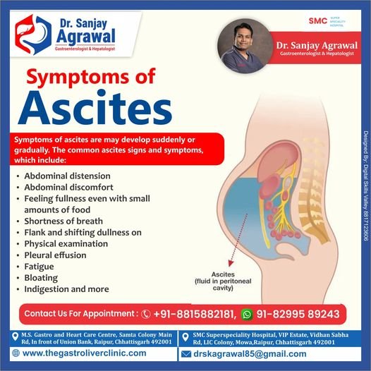 Ascites: Symptoms, Causes, and Expert Care in Raipur