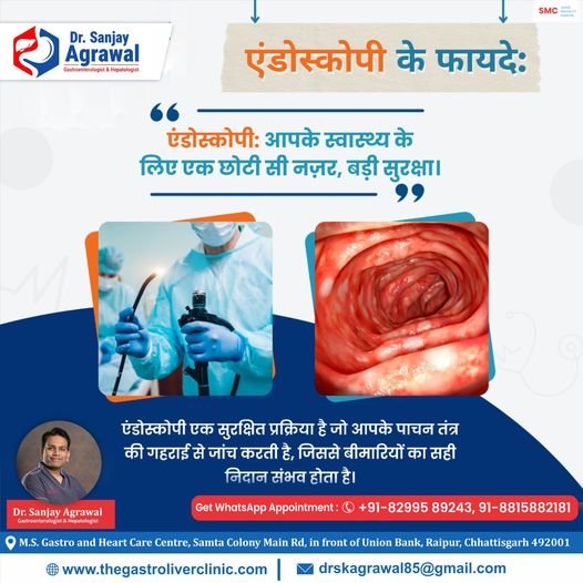 What is endoscopy|Dr Sanjay Agrawal